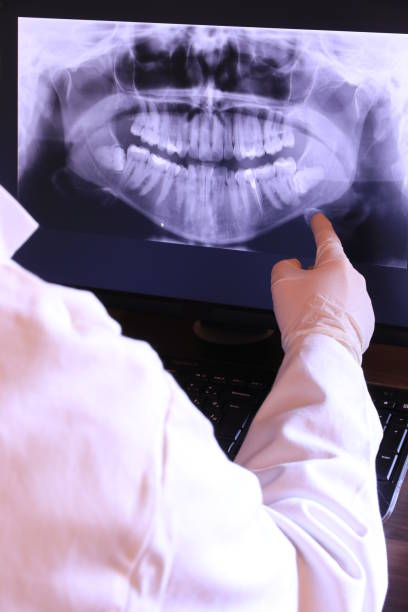 Best Emergency Dental Care for Broken or Chipped Teeth in Rehobeth, AL
